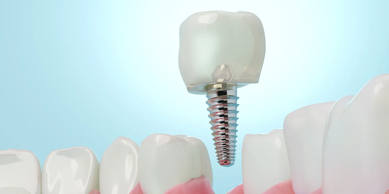 歯医者が苦手な方へ